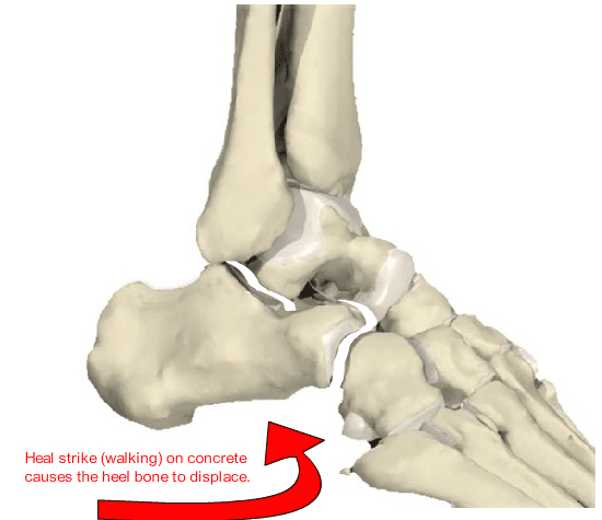 Foot Pain - North Oakland Chiropractic Clinic