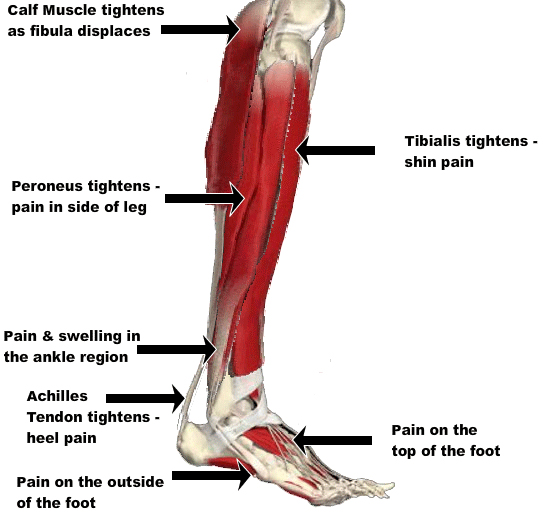 Foot Pain - North Oakland Chiropractic Clinic